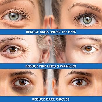 The Significance of Eye Care: Justifications for Creating a Committed Regimen for Your Eye Region